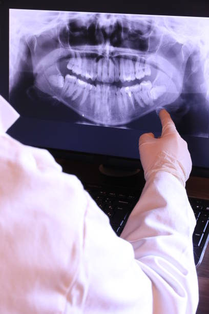 Best Emergency Tooth Extraction in Lmer Heights, PA
